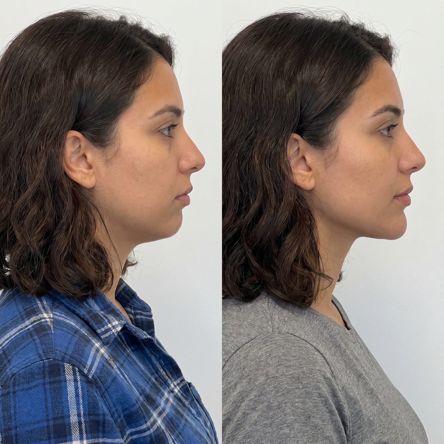 Vital® Firming Neck Cream With Roller