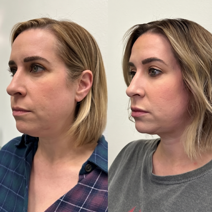 Vital® Firming Neck Cream With Roller