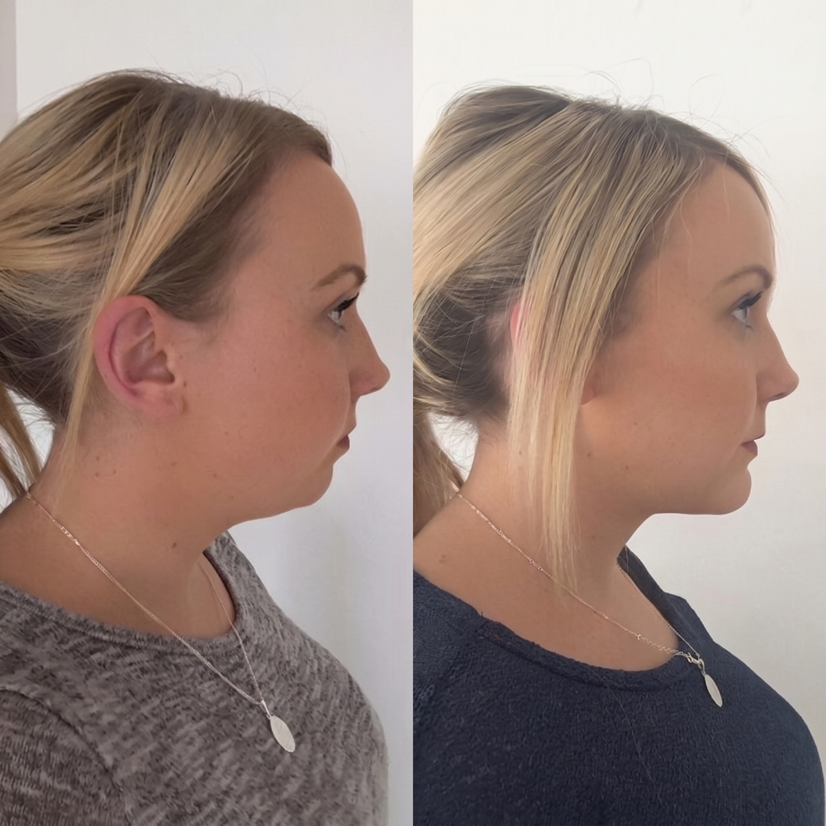 Vital® Firming Neck Cream With Roller