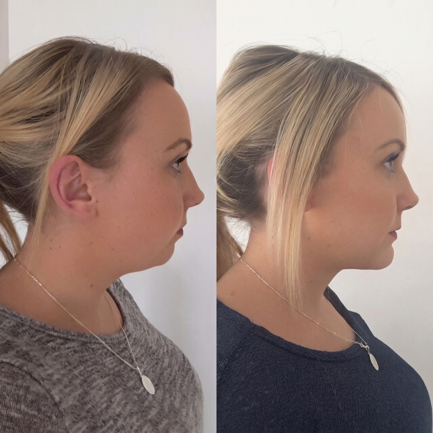 Vital® Firming Neck Cream With Roller