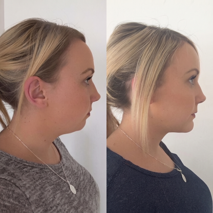 Vital® Firming Neck Cream With Roller